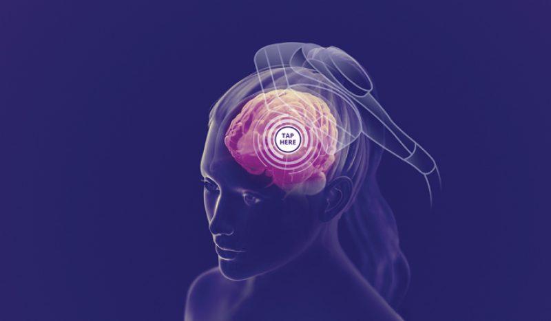 Brand Scan Showing Where on the Brain NeuroStar Treats